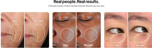 Photonic Silicone Facial Mask Instrument Multi-function - MedSpa-inspired mask